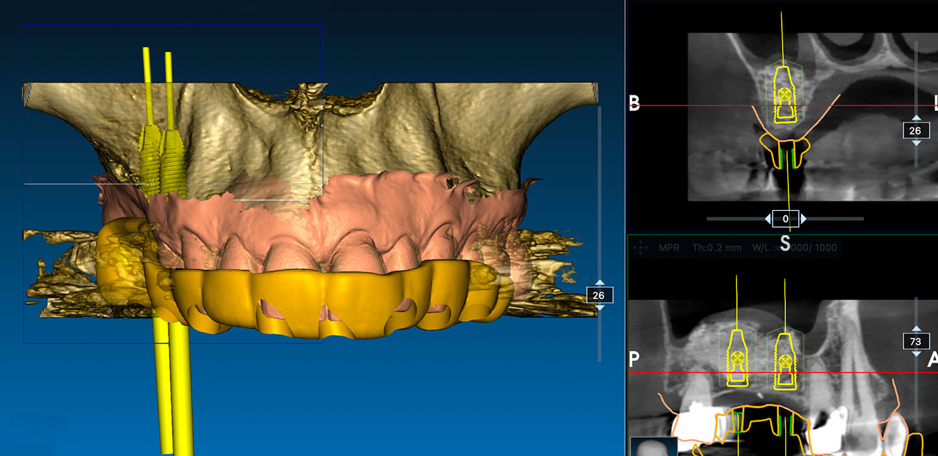 Zahnarzt Düsseldorf-Pempelfort - Smile 3D